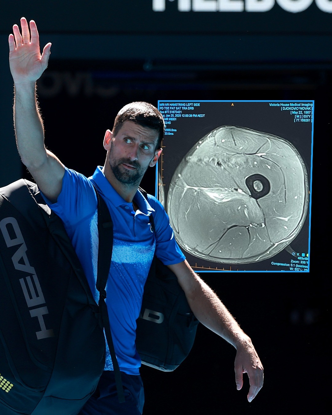 包含德国网球队爆冷日本网球队，德约科维奇送出助攻的词条